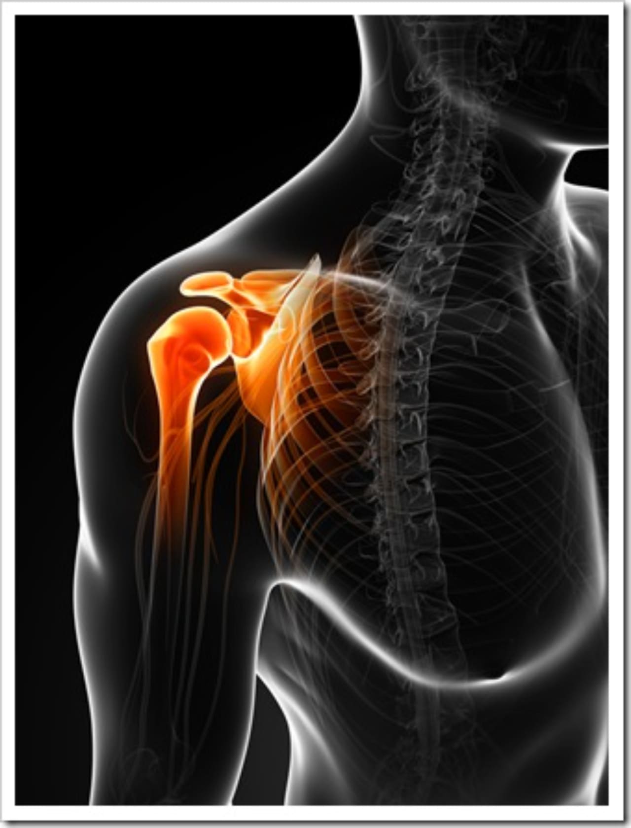 Frozen Shoulder Jackson MS Neck Pain