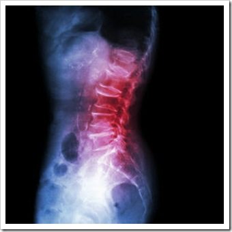 Jackson Back Pain